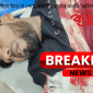 নোয়াখালীতে চাঁদা না পেয়ে প্রবাসীর হাতের কবজি কাটল সন্ত্রাসীরা
