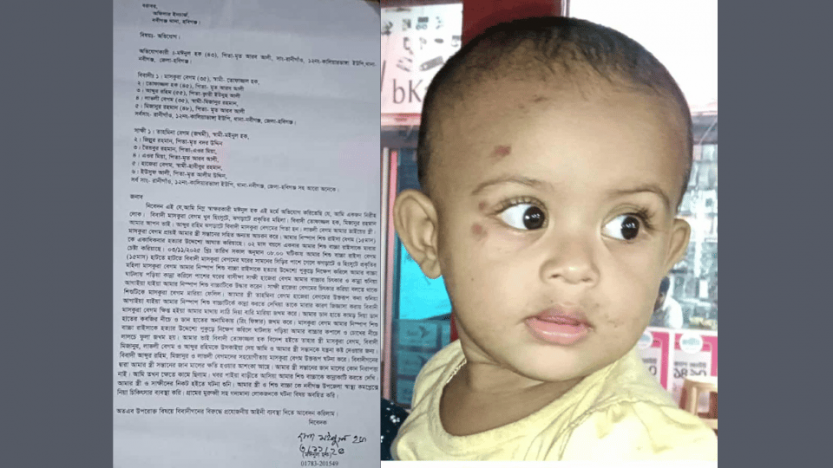 অবুঝ ১৫ মাসের শিশুকে প্রাণে হত্যার হামলা