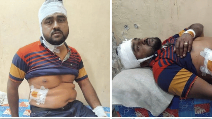 দৌলতপুরে তুচ্ছ ঘটনাকে কেন্দ্র করে বিএনপি-কর্মীর উপর জামায়াতের হামলা ৫ বিএনপি কর্মী আহত